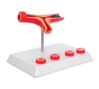 Hemobllo Human Blood Vessel Model Vascular Blockage Anatomical Teaching Aid Medical Plastic Cardiovascular Simulation for Classroom and Medical Education