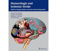 Hemorrhagic and Ischemic Stroke: Medical, Imaging, Surgical and Interventional Approaches