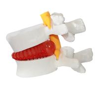 Herniated Disc Relief Teaching Aids, PVC Human Body Model of Herniated Lumbar Vertebrae Disc, 1.5 Times Life Size Lumbar Spine Model for Teaching, Learning and Demonstrating Spine Model Chiropractic S