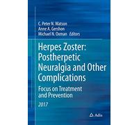 Herpes Zoster: Postherpetic Neuralgia and Other Complications: Focus on Treatment and Prevention