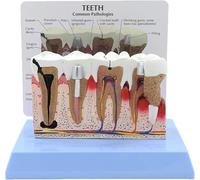 HGAYUBDV Teeth Cross-Section Model, Dental Teeth Model, Pathology Demonstration Dental Model with Instructions, Human Teeth Anatomy Model for Dentist Office Educational Tool.