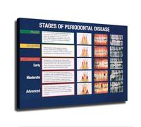 HGETJOHXEM Professional, Gum Disease Progression Chart illustrating 4 Stages, Educational Canvas Wall-Art for Clinic, Classroom Study Room Decor(Framed,12x18inch(30x45cm))