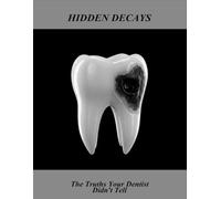 Hidden Decays: The Truths Your Dentist Didn'T Tell