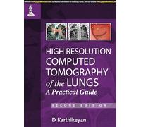 High Resolution Computed Tomography of the Lungs: A Practical Guide