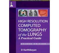 High Resolution Computed Tomography of the Lungs: A Practical Guide