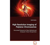 High Resolution Imaging of Polytene Chromosomes: Illustrated Protocols of New Method and Computer Vision Perspectives