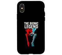 Hip Surgery The Bionic Legend Fun Mens Get Well Case for iPhone X/XS