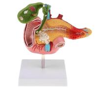 HiyyFloy Human Pancreatic Duodenum Gallbladder Pathological Anatomy Model, Life Size Medical Education Digestive System Anatomical Teaching Models