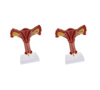 Hklshyd 2X 1:1 Human Female Uterus Ovary Fallopian Tubes Model Anatomical Human Anatomy Model Teaching Tools