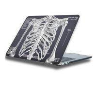 HLAAJJX Pattern Case Compatible with MacBook Pro 14 inch 2021-2025 2026 | M1 M2 M3 M4 M5 Pro/Max Anti-Cracking Case Unique Protective Hard Shell Cover for Mac Pro 14.2 inch, Skeleton Scan