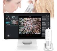 hocvseo Hair Scalp Detector, 16 Million Scalp Hair Follicle Analyzer, 10X 200X Scalp Hair Follicle Oil Moisture Magnifying Detector, for Home, Beauty Salon