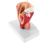 Homoyoyo Enlarged Throat Model Portable Medical Teaching Aid for Schools Hospitals