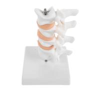 Homoyoyo Human Lumbar Spine Model and Research Reference Specimen Osteoporosis Display Anatomy with Stand, Pvc Material for Scientific Research and Clinical Instruction