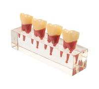 Housoutil Teeth Model with Resin Oral and Interactive Removable Teeth for Hands-on Practice, for Pediatric Caries Model Studies and Oral Health Education