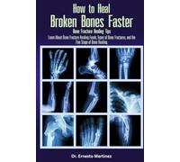 How to Heal Broken Bones Faster. Bone Fracture Healing Tips: Learn About Bone Fracture Healing Foods, Types of Bone Fractures, and the Five Stages of Bone Healing: 5 (Health and Wellness)