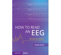 How to Read an EEG