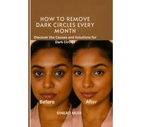 HOW TO REMOVE DARK CIRCLES EVERY MONTH: Discover the Causes and Solutions for Dark Circles