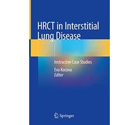 HRCT in Interstitial Lung Disease: Instructive Case Studies