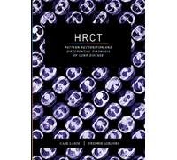 HRCT : pattern recognition and differential diagnosis of lung disease