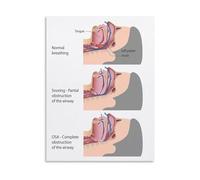 HSMXNEONJB Health Education Poster Sleep Apnea Information Chart Educational Wall-Art for Classroom Clinic Study Office Decor(Unframed,16x24inch(40x60cm))