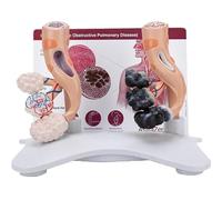 Human Alveolar Anatomical Model, Smoking vs Healthy Alveoli Comparison, Enlarged Lung Structure Model for Health Teaching, Education and Classroom Display