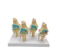 Human Anatomical 4-Stage Knee Joint Skeleton Model Educational Medical Teaching Tool Drop Shipping