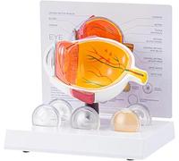 Human Anatomical Eye Model, Cataract Eye Model, Pathological Eyeball Anatomy Model for Clinical Setting Teaching Demonstration Lecture Report