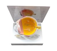 Human Anatomical Eye Model Pathological Eyeball Anatomy for Clinical Setting Teaching Demonstration Lecture Report PVC Eyeball