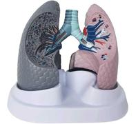 Human Anatomical Lung Model, Life Size Smoking and Normal Lung Models, Normal and Pathological Lung Anatomy Model, Lung Anatomy Model for Smoking Education