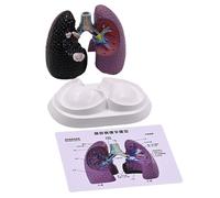 Human Anatomical Lung Model Realistic Pathological Lung Anatomy Model for Teaching Demonstration and Educational Use Education Tool