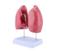 Human Anatomical Lung Model with Detachable Parts Normal Lung Anatomy Model for Clinical Settings and Lecture Report Educational