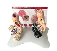 Human Anatomical Model, Human Lung Health Alveolar Mode Human Organ Anatomical Model Viscera Alveoli Enlarge Model Educational Training Aid