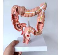 Human Anatomical Model - Large Intestine and Colon Model for Anatomy and Physiology Education, Digestive System Study Aid