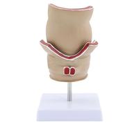 Human Anatomical Model Pathologies of Rectum Teaching Aid Rectum for Science Class Human Pathologies of Rectum Model