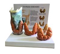 Human Anatomy Laryngeal Pathology Model, Human Thyroid Anatomical Pathology Model, Normal and Disease Pathology Medical