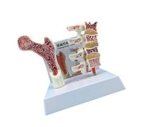 Human Anatomy Osteoporosia Model for Teaching Display Osteoporosia Spine Model Vertebrae Anatomical Skeleton Human Anatomy Vertebrae Anatomical Skeleton for Study