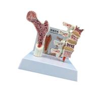 Human Anatomy Osteoporosia Model for Teaching Display Osteoporosia Spine Model Vertebrae Anatomical Skeleton Vertebrae Anatomical Skeleton Spine School Supplies