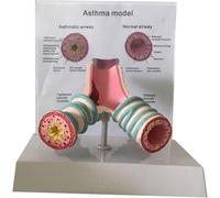 Human Asthma Anatomy Model Respiratory System Bronchial Model for Students Study Display Teaching