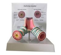 Human Asthma Anatomy Model - Respiratory System Bronchial Model For Students Study Display Teaching Model