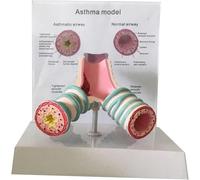 Human Asthma Anatomy Model, Tracheal Case Anatomical Model, Human Respiratory System Bronchial Medical Teaching Aids, for School Nursing Learning and Display