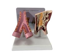 Human Blood Vessel Anatomy Model Featuring Comparative Display of Healthy and Smoker Pathological Vessels with Detailed and Accurate Anatomical Structure for Educational Use