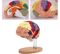 Human Brain Anatomy Model for Study of Brain Diseases, Educational Organ Teaching Model, Detailed Brain Structure Display for Students and Educators