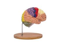 Human Brain Artery Anatomy Model 2X Magnification Cerebrovascular Neurological Brain Model 4 Removable Parts with 50+ Precise Markings 1pcs