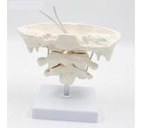 Human Cervical Vertebra Model, Atlas Axis Occipital Bone Display | Realistic Skeletal Replica Showing Skull-Cervical Joint Structure, Durable PVC Construction for Professional Demonstration