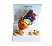 Human Detachable Heart Anatomy Model with Base, Atrial Fibrillation Heart Model for Anatomy and Physiology, Scientific Medical Teaching Aid for Doctor-Patient Communication