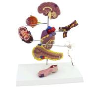 Human Diabetic Organ Anatomy Model 8 Parts Organ Model Diabetes Complications Model as Educational Teaching Aids (A)