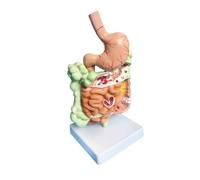 Human Digestive System Anatomy Model Detachable Intestinal and Colon Teaching Model with Pathology Display, Square Base Human Torso Model