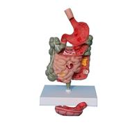 Human Digestive System Anatomy Model,Gastrointestinal Tract Pathological Model