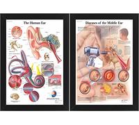 Human Ear & Diseases Of The Middle Ear - Human Body Anatomical System, Educational Medical Posters, Professional Wall Charts, Labeled Diagrams Display (Framed, A3)
