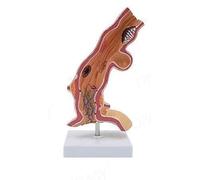 Human Esophageal Pathological Model, Removerable Esophageal Anatomy Model, 5X Magnification Esophageal cancer Longitudinal Digestive System Model, for Medical Teaching Demonstrations
